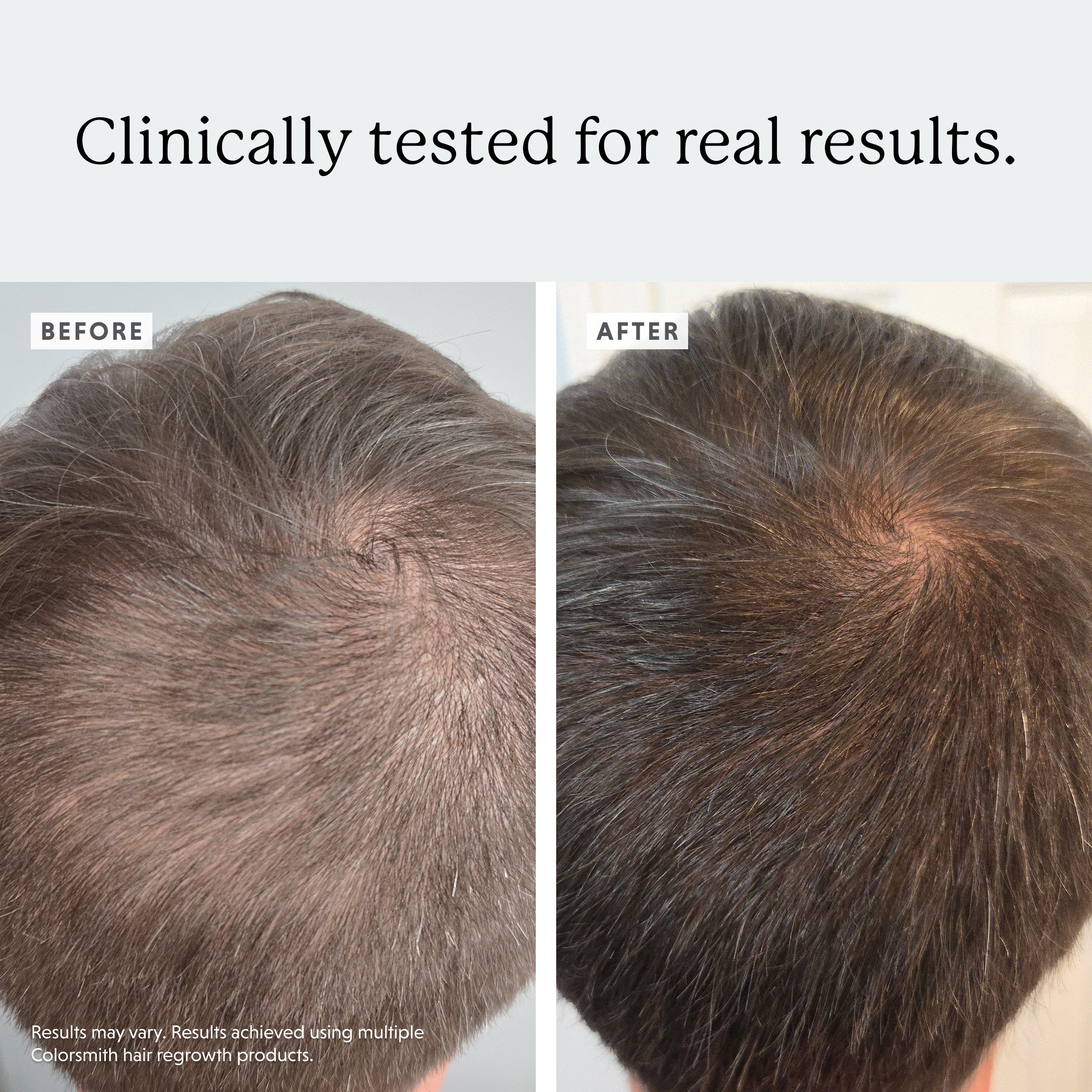 Soothing Scalp Serum