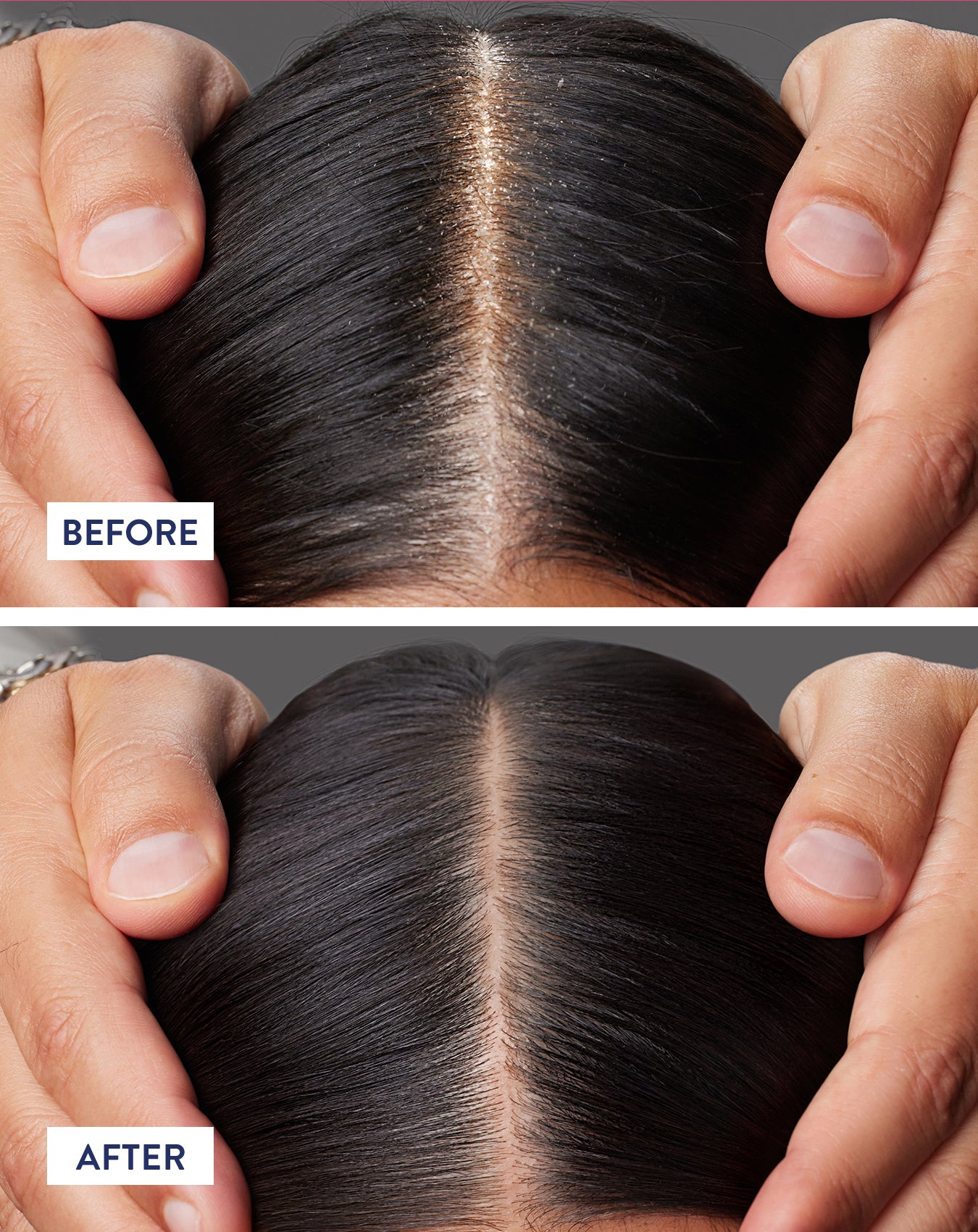 JOICO Scalp Vitality Exfoliating Foaming Scrub