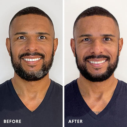 Permanent Hair & Beard Color for Full Gray Coverage