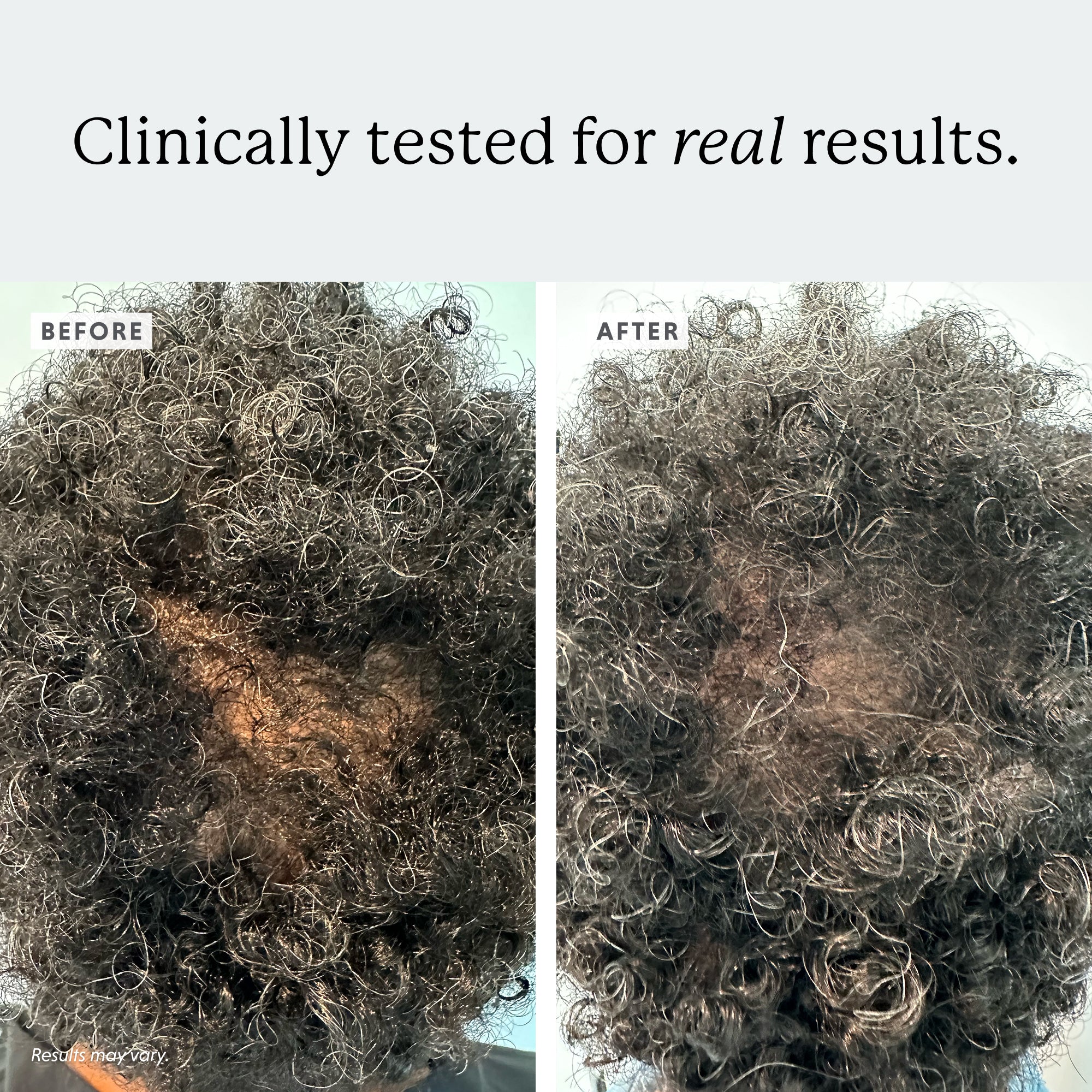 Colorsmith Hair Regrowth Treatment
