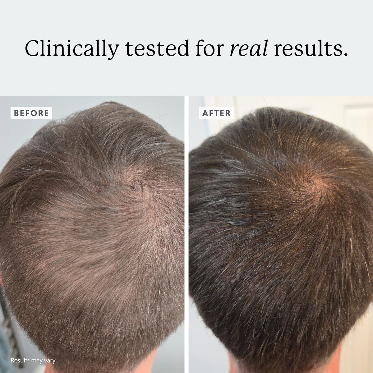 3-in-1 Hair Growth Bundle: Gummies