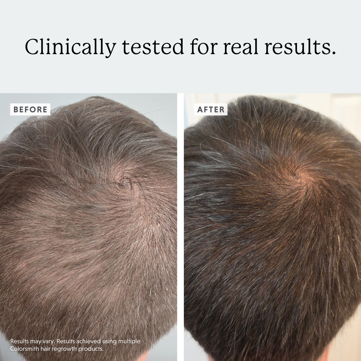 Soothing Scalp Serum
