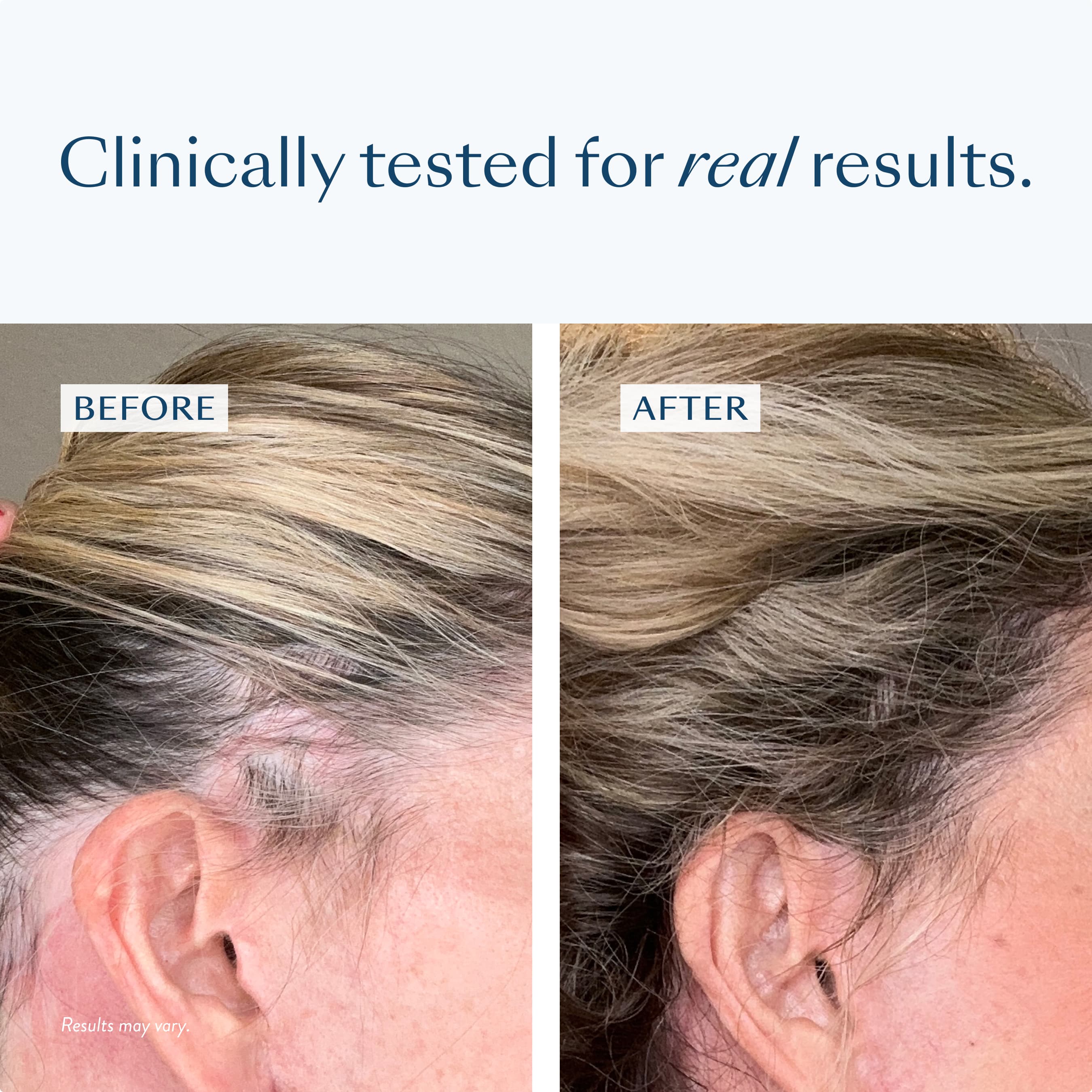 Hair Regrowth Treatment + Densifying Scalp Serum